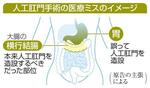 医療ミスで胃に人工肛門